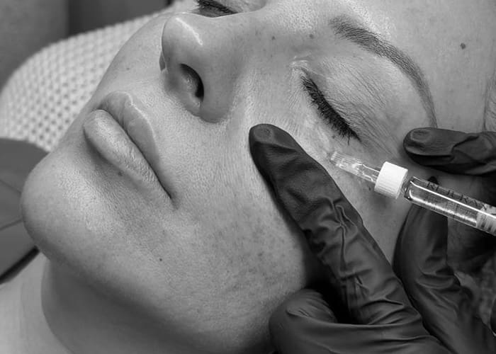 Rejuran Treatment at Glow Cosmetique