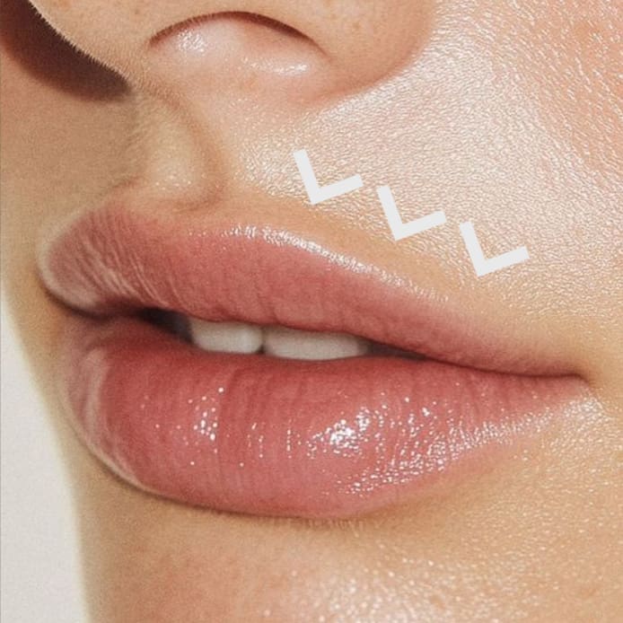 Lip Migration